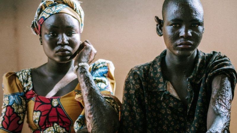 Após perderem a família em ataque do Boko Haram, órfãos relatam: ‘Deus mandou perdoar’