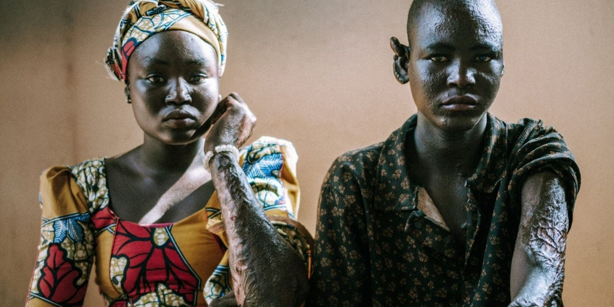 Após perderem a família em ataque do Boko Haram, órfãos relatam: ‘Deus mandou perdoar’